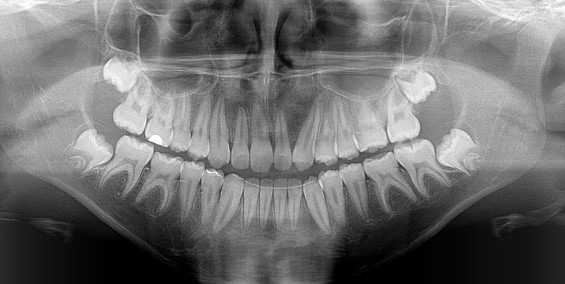 Maxillofacial Dentistry in Durban | Dr J. Francois Coetzee