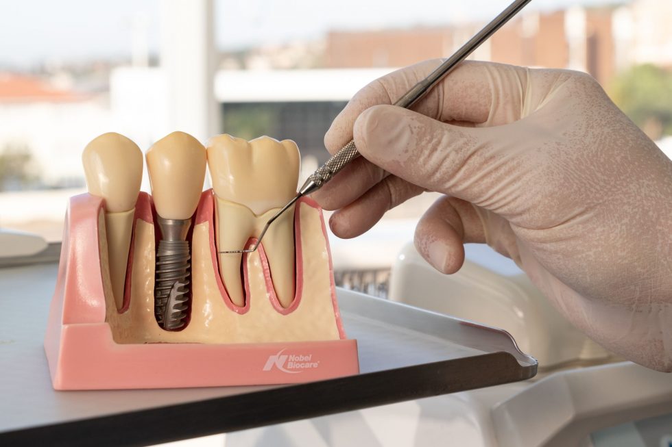 Prosthodontic Dentistry Dr J. Francois Coetzee Dental Surgeon