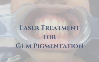 Laser Treatment for Gum Pigmentation