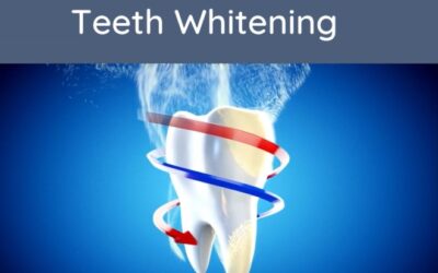 Teeth Whitening Durban