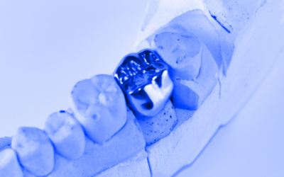 Types of Dental Crowns: Pros and Cons